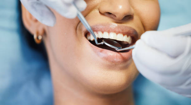 Best Emergency Dentist for Lost Fillings or Crowns in Lumbine Valley, CO